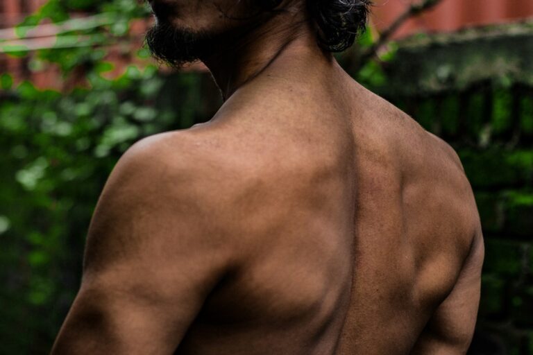 Rückenhaare dauerhaft entfernen lassen - Männerbehandlung Hannover